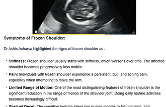Frozen shoulder: Management and treatment options
