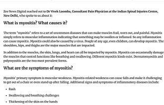 Is Myositis, the disease Samantha Ruth Prabhu is diagnosed with, INCURABLE? Doctor on symptoms, care and more