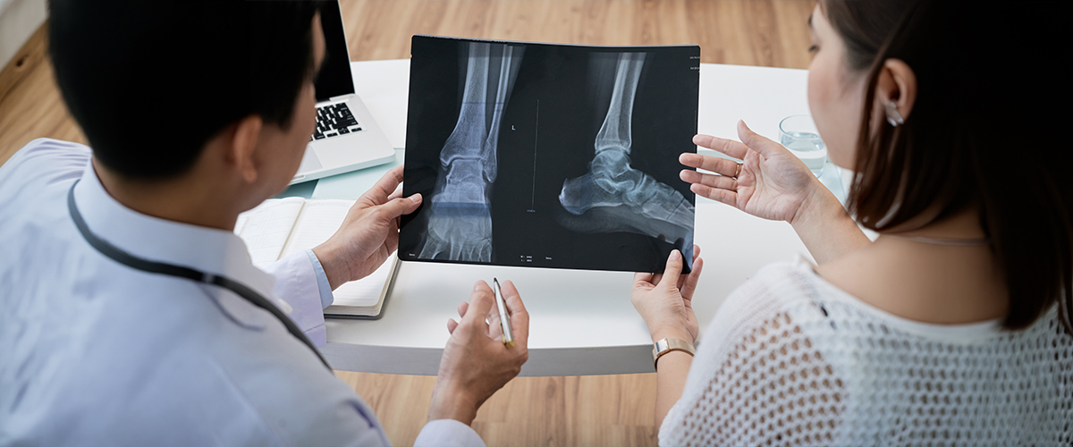 osteoporosis-foot-and-leg
