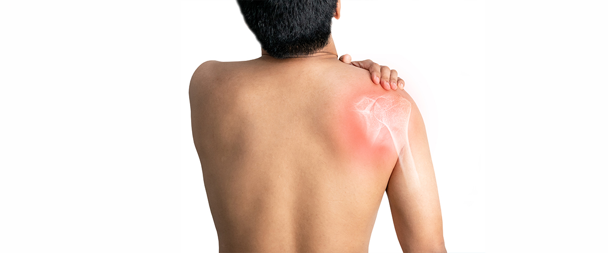 sciatica-shoulder-and-arm