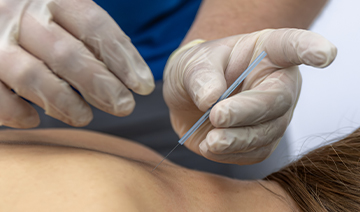 epidural-injections