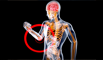 genicular-nerve-block-and-radiofrequency-ablation-gnrfa