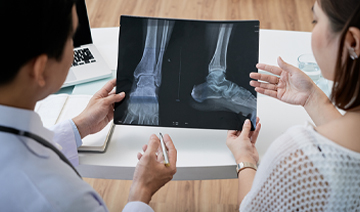 osteoporosis-foot-and-leg