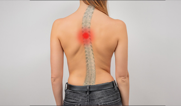 sacroiliac-joint-dysfunction
