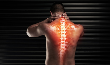 scheuermanns-disease-kyphosis