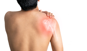 sciatica-shoulder-and-arm