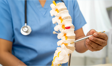spinal-osteoarthritis