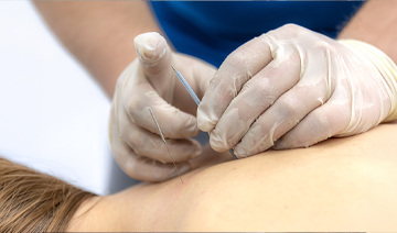 trigger-point-injections