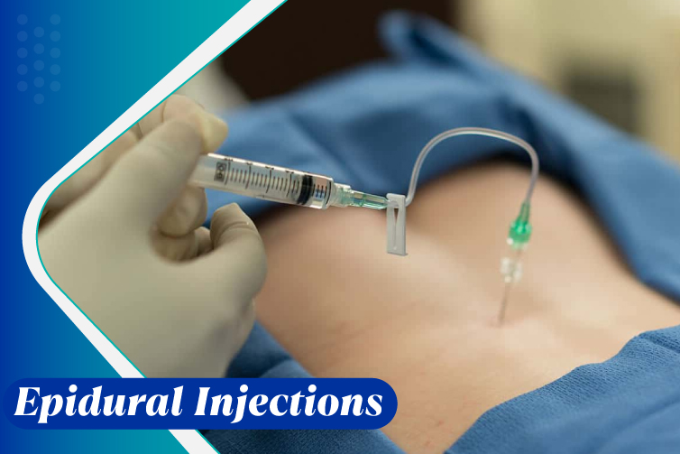 Epidural-Injections