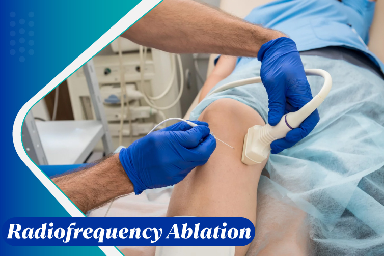 Radiofrequency-Ablation