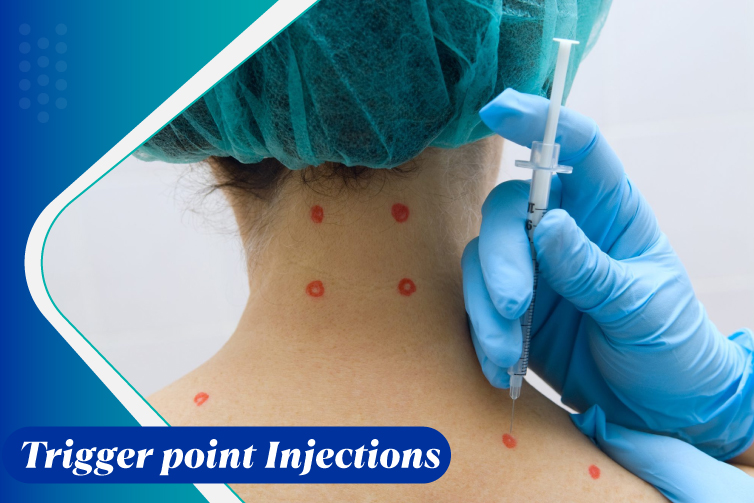 Trigger-point-Injections