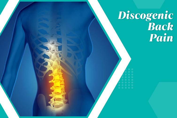 Discogenic Back Pain